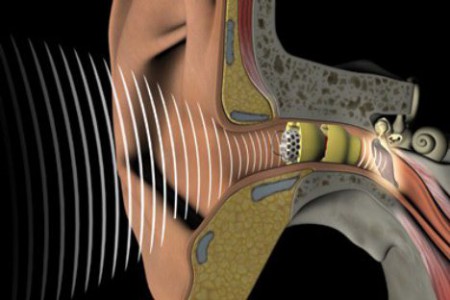 Here you see exactly how sound goes through your ear